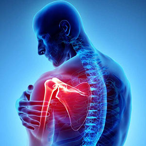 بیماری آرتروز